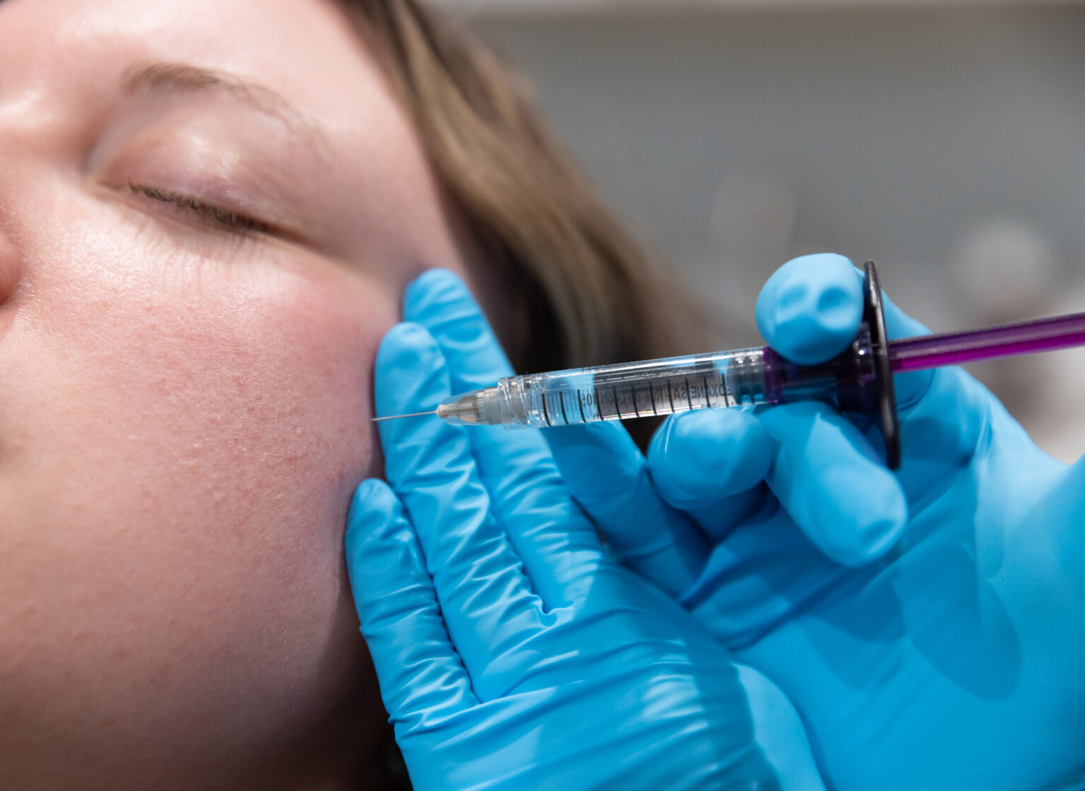 Sculptra in Toledo Blush Aesthetics