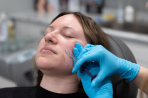 Dermal Filler Toledo