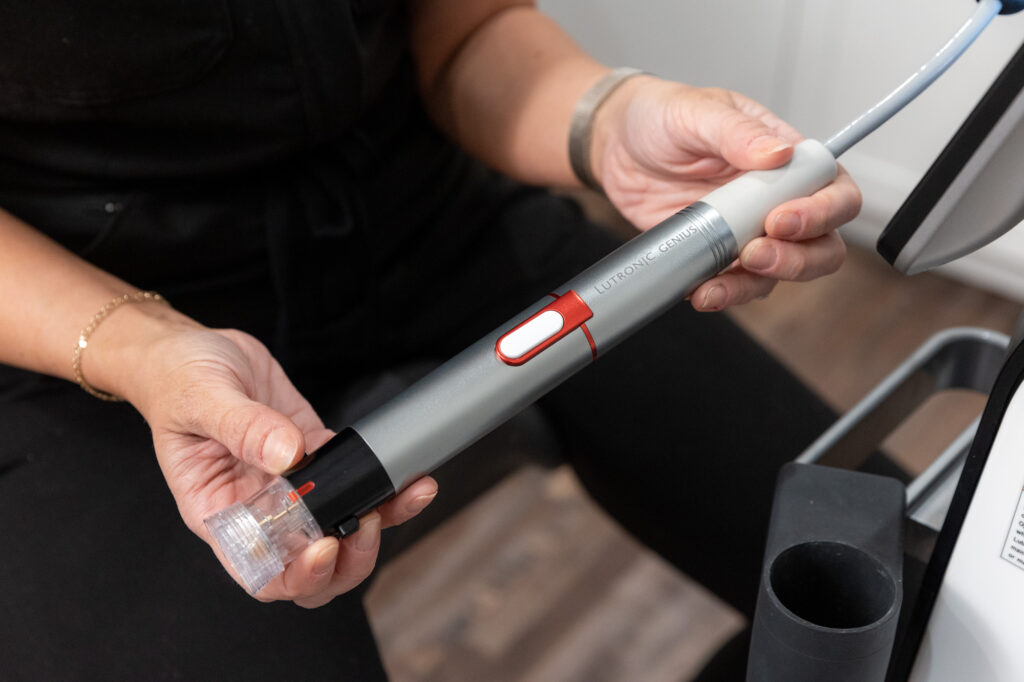 a skincare provider holds a silver device used for microneedling with radiofrequency in Perrysburg