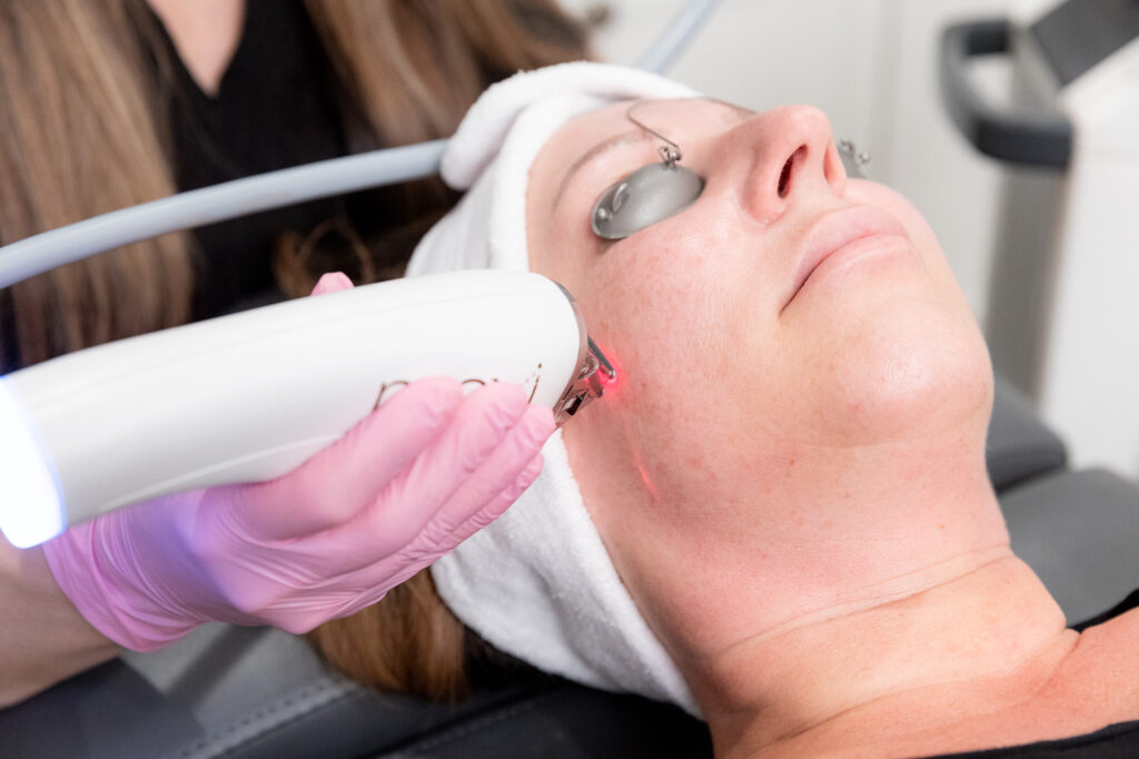 Close-up of a professional with pink gloves performing a hyperpigmentation treatment in Toledo on a female patient's face with a laser